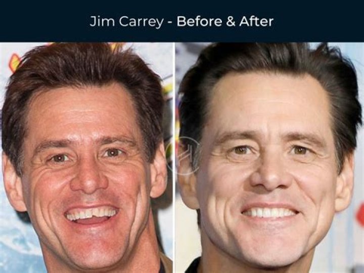 Who will replace Jim Nantz?