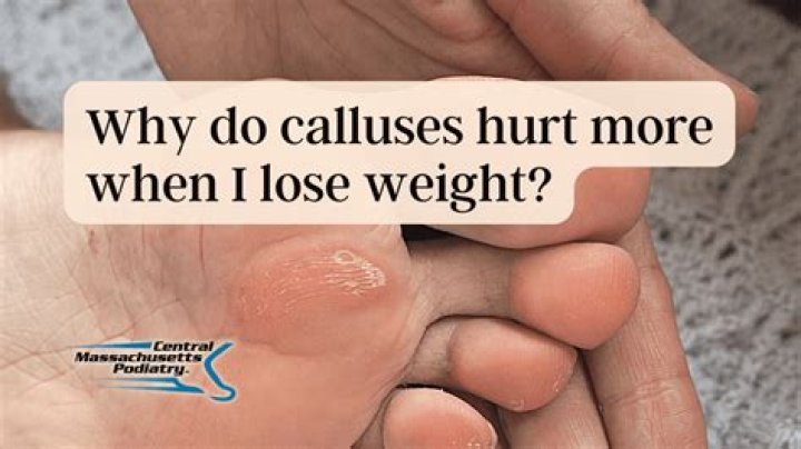 Why do calluses hurt?