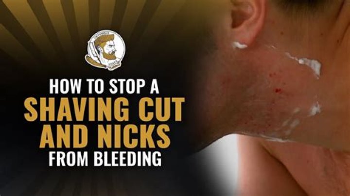 Why do I bleed after shaving?