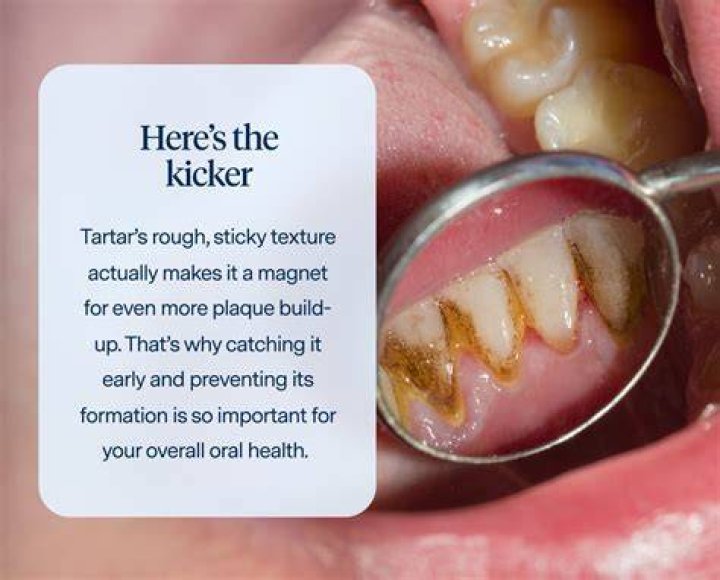 Why do I get tartar on my bottom teeth?