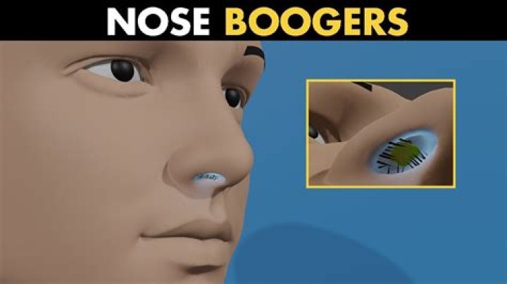 Why do I have a lot of boogers?