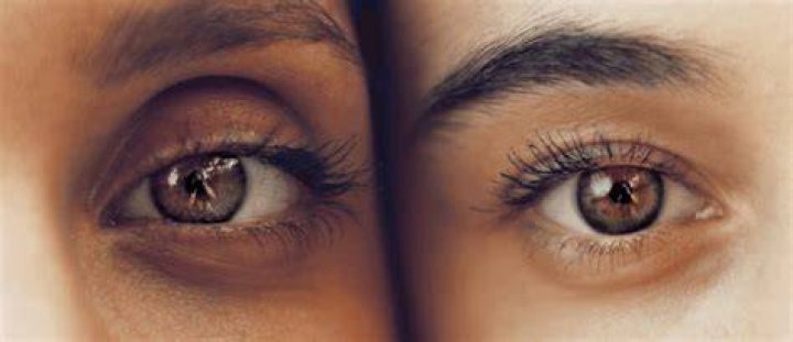 Why do I have dark circles even when I get enough sleep?