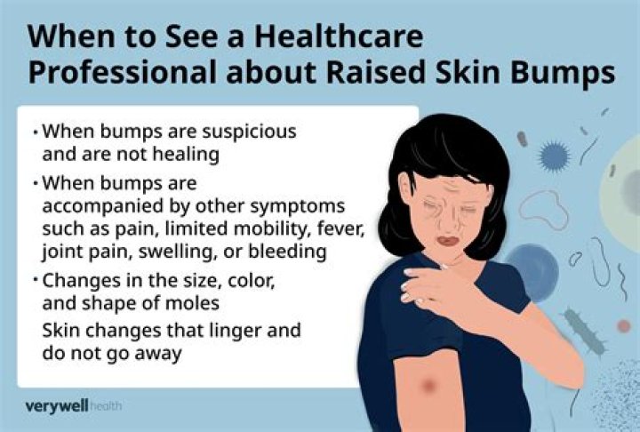 Why do I have raised bumps on my skin?