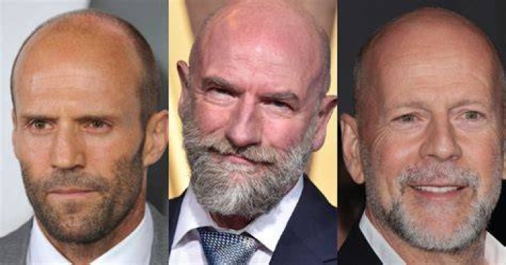 Why do I like bald guys?