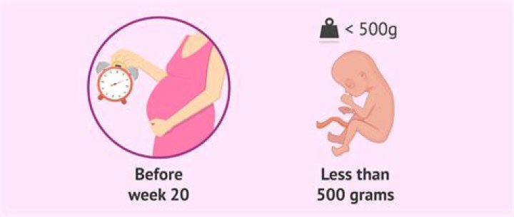 Why do most miscarriages happen at 7 weeks?