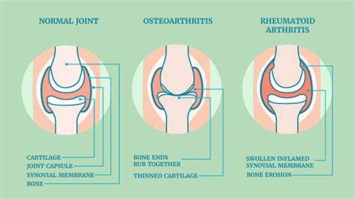 Why do my knees hurt after skate skiing?