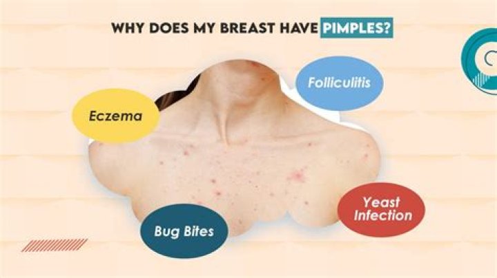 Why do my nipples look bigger?