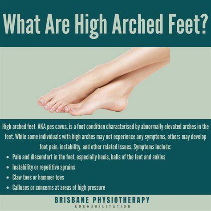 Why do shoes with arches hurt my feet?
