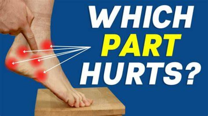 Why does my ankle hurt after snowboarding?