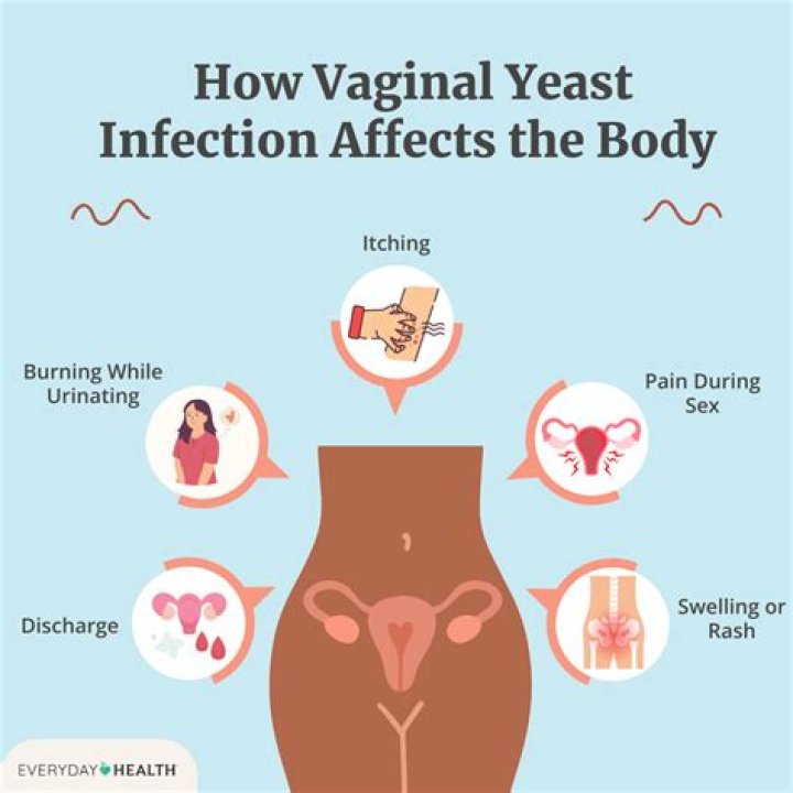 Why does yeast infection keep coming back?