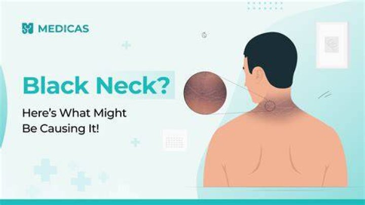 Why is my neck skin so loose?