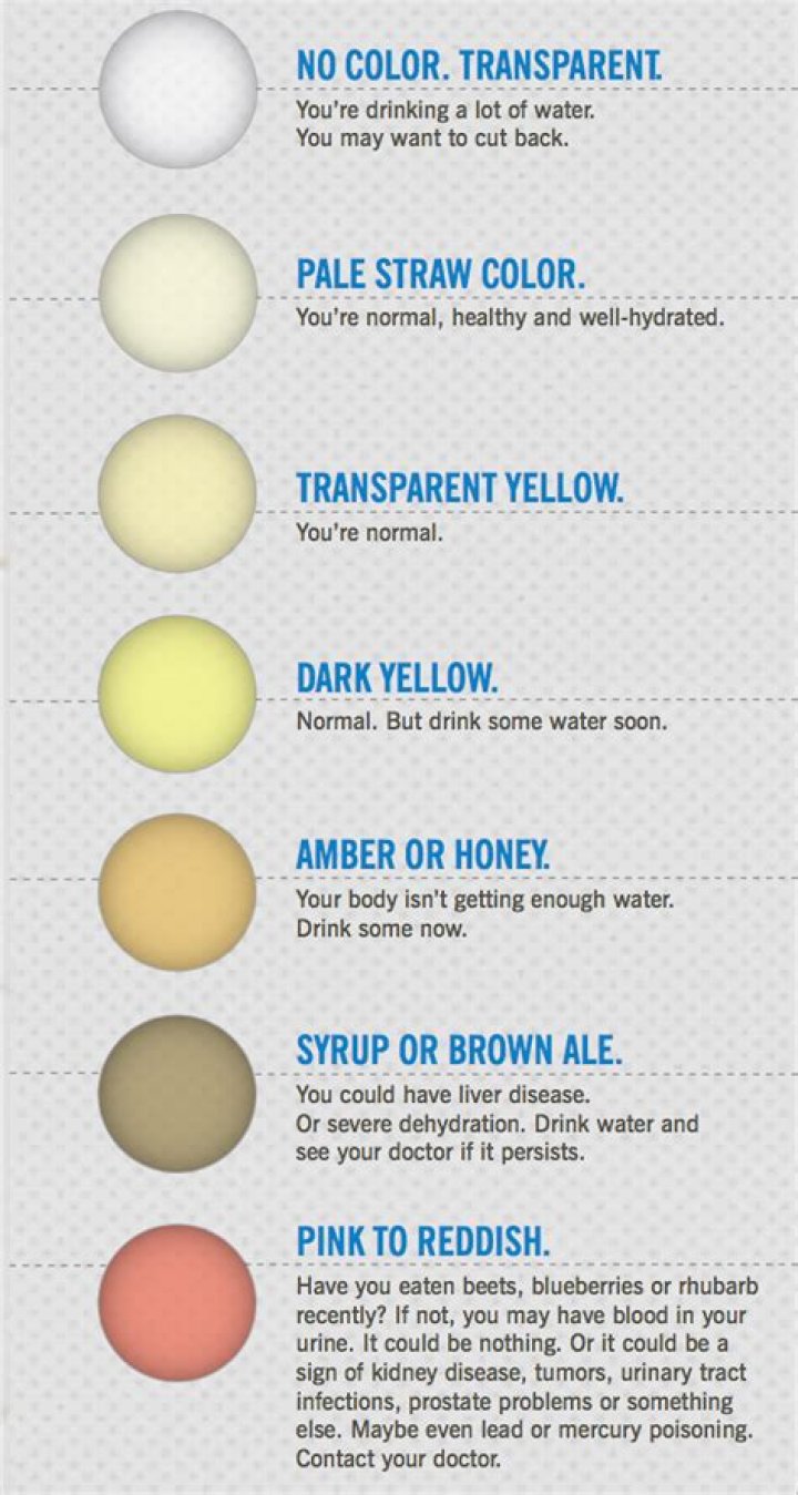 Why is my pee white?