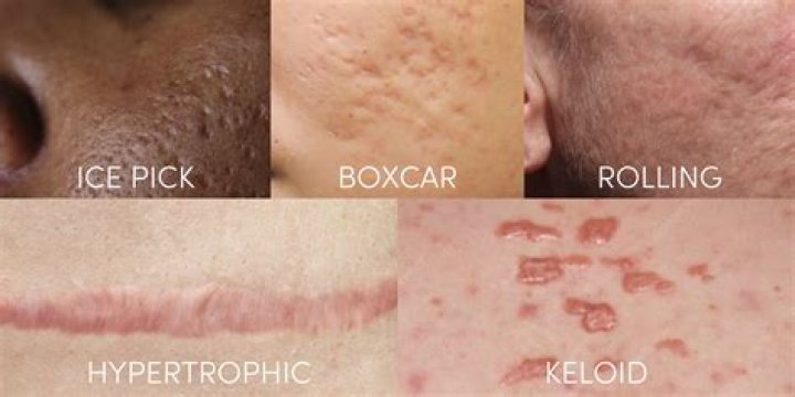 Why is my scar still red after 2 years?