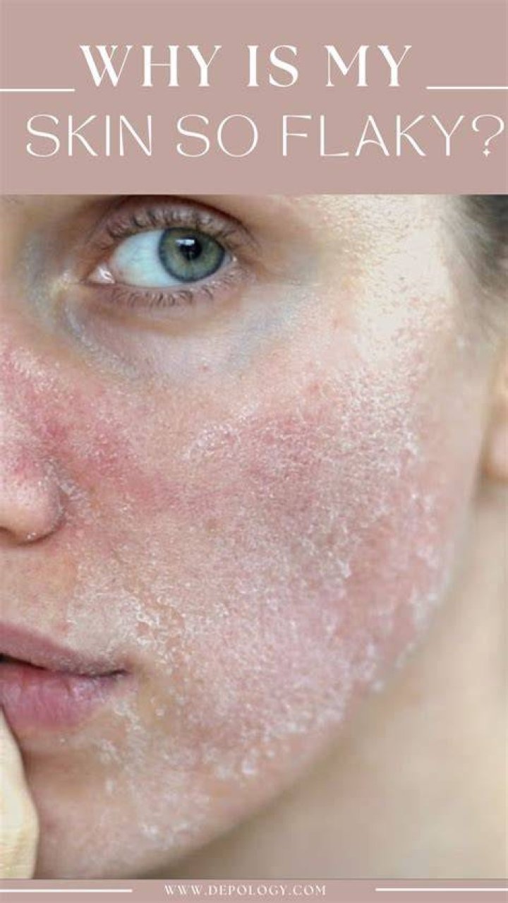 Why is my skin not healing?