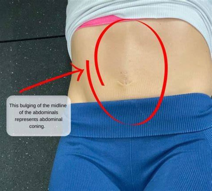 Why is my stomach bigger above my belly button?