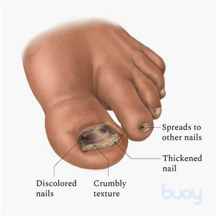 Why is my toenail pulsating?