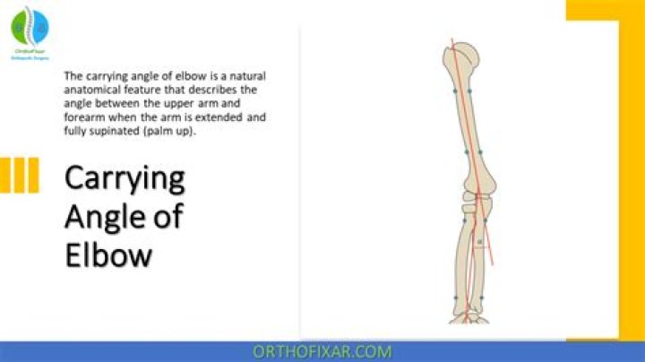 Why is the elbow carry a good choice?