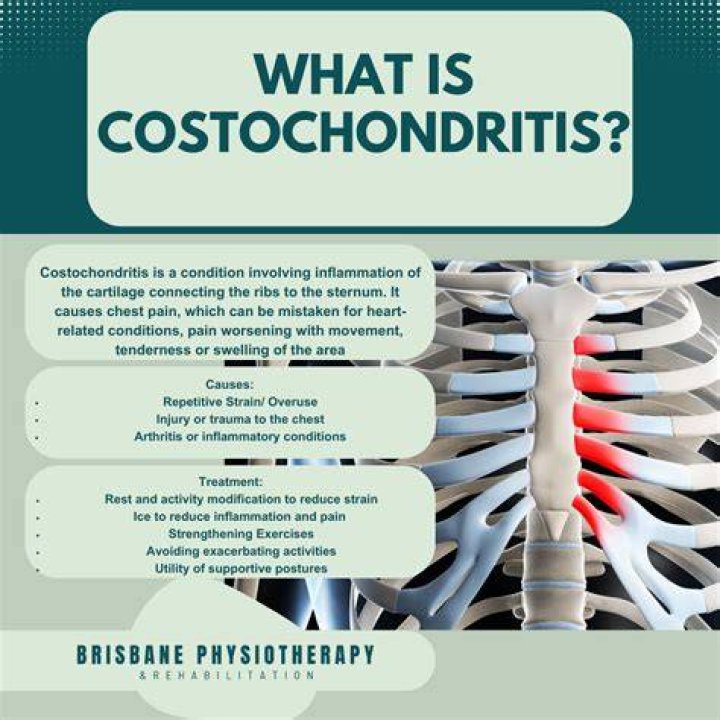 Will I have costochondritis forever?