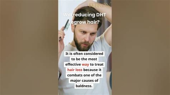 Will reducing DHT regrow hair?